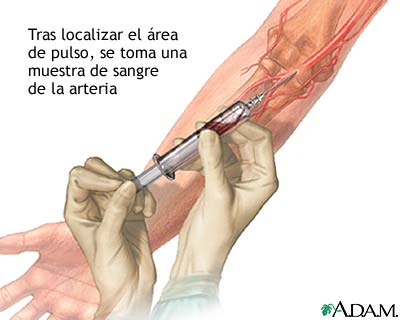 liberación específica de fracción de antígeno prostático